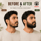Before and after comparison of a man's beard growth and grooming, with the ibeard logo in the top right corner. The left side is labeled 'BEFORE' and shows a man with a lighter stubble beard.