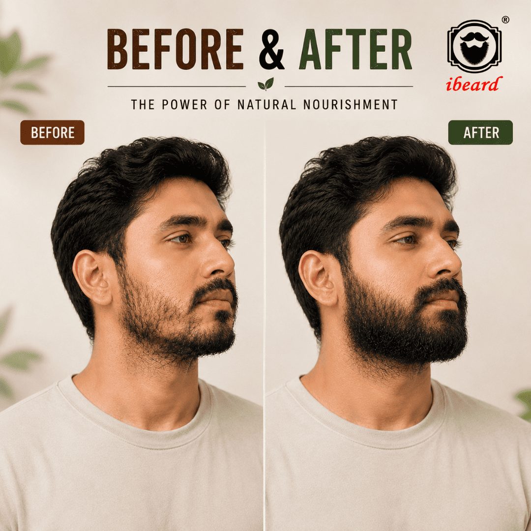 Before and after comparison of a man's beard growth and grooming, with the ibeard logo in the top right corner. The left side is labeled 'BEFORE' and shows a man with a lighter stubble beard.